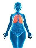 Illustration of an obese woman's lung