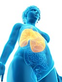 Illustration of an obese woman's lung