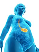 Illustration of an obese woman's stomach