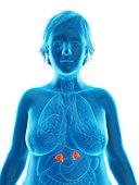 Illustration of an obese woman's adrenal glands