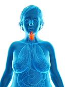 Illustration of an obese woman's larynx