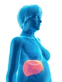 Illustration of an obese woman's liver