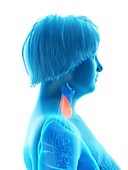 Illustration of an obese woman's thyroid gland