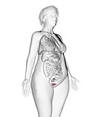 Illustration of an obese woman's bladder