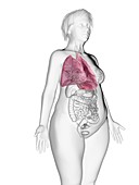 Illustration of an obese woman's lung