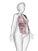 Illustration of an obese woman's internal organs