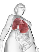 Illustration of an obese woman's lung