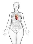 Illustration of an obese woman's heart
