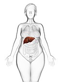 Illustration of an obese woman's liver