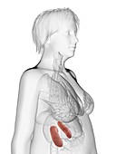 Illustration of an obese woman's kidneys