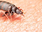 Illustration of a bedbug on human skin