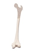 Illustration of a healthy bone structure