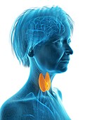 Illustration of an old woman's thyroid gland