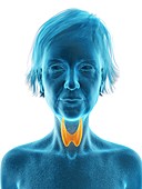 Illustration of an old woman's thyroid gland