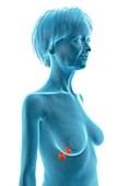 Illustration of an old woman's adrenal glands