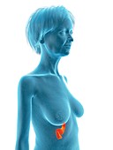 Illustration of an old woman's pancreas