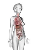 Illustration of an old woman's organs