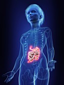 Illustration of an inflamed small intestine