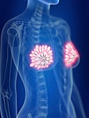 Illustration of inflamed mammary glands