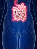 Illustration of an inflamed small intestine