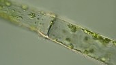Protein transport in algal cells, light microscopy footage