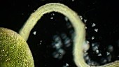 Vorticella protozoa on a rootlet, light microscopy footage