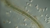 Vorticella protozoa, light microscopy footage