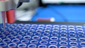 PCR robot testing biological samples