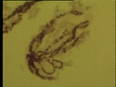 Chromosome microscopy