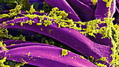 Bubonic plague bacteria
