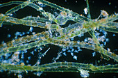 Vorticella on Green Algae Filaments, LM