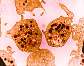 Platelets (TEM)