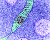 Hemiptera Sperm (TEM)
