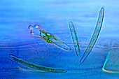 Diatoms, Polarized LM