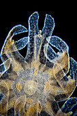 Jellyfish ephyra, LM