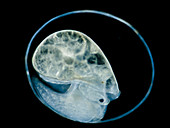 Freshwater snail embryo (Physa sp.), LM