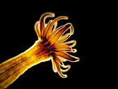 Sea anemone (Anemonia sp.) polyp, LM