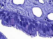 Bronchial Mucosa Bronchial Epithelium, LM