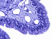 Bronchial Mucosa & Bronchial Epithelium, LM