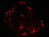 Pancreatic Islet Stained for D Cells, LM