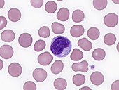 Red and White Blood Cells, LM