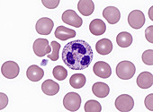 Red and White Blood Cells, LM