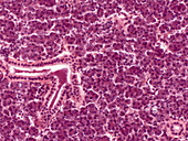 Parotid Gland, LM