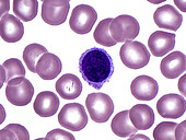 Blood Smear, LM