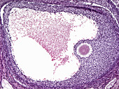 Secondary Ovarian Follicle, LM