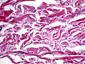 Connective Tissue, LM