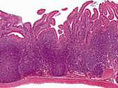 Ileum, Peyer's Patches, LM