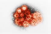 Enterovirus, TEM