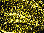 Glia in the Dentate Gryus of Hippocampus