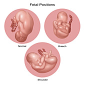 Foetus Positions in Uterus, Illustration